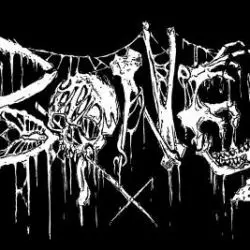 Bones
