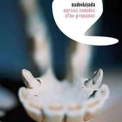 Radiokijada