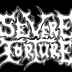Severe Torture