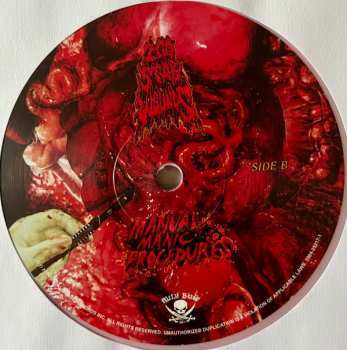 LP 200 Stab Wounds: Manual Manic Procedures CLR