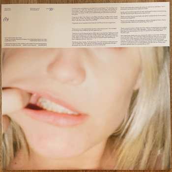 LP Anne-Marie: Unhealthy CLR