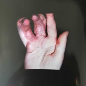 LP Arca: Xen