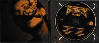 CD Beartooth: Disease