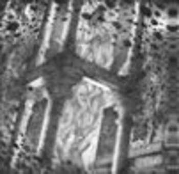 LP Bedsore: Bedsore / Mortal Incarnation LTD