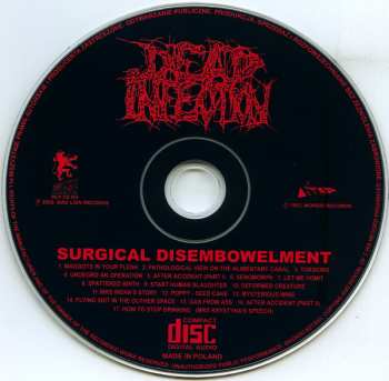 CD Dead Infection: Surgical Disembowelment