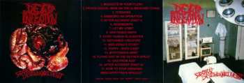 CD Dead Infection: Surgical Disembowelment