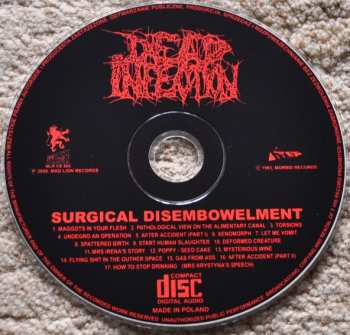 CD Dead Infection: Surgical Disembowelment