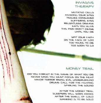 CD Dioxyde: Social Phobia