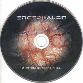 2CD Encephalon: We Only Love You When You're Dead DLX
