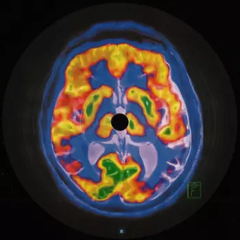 Frankey & Sandrino: Brainscan EP