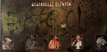 LP Haemorrhage: Anatomical Inferno CLR | LTD
