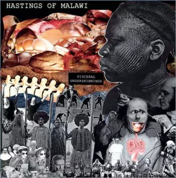 Hastings Of Malawi: Visceral Underskinnings
