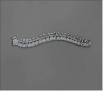 When The Blood Turns Black