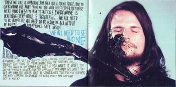 CD Kisschasy: Seizures