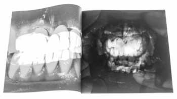 EP Last Rizla: KLS9532 LTD | NUM