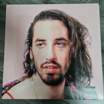 2LP Lomepal: FLIP