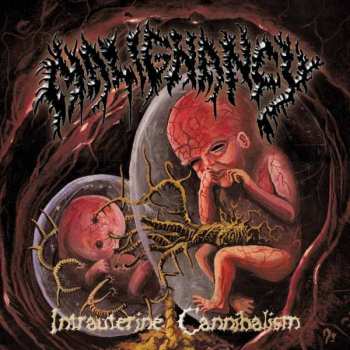 Album Malignancy: Intrauterine Cannibalism