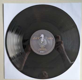 LP Mathew V: Anything Goes