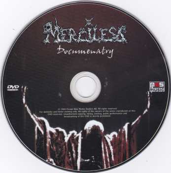 2DVD Merciless: Live Obsession