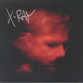 Murdock: X-Ray