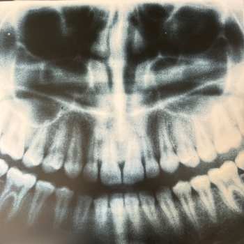 LP Nerone: Penkiller