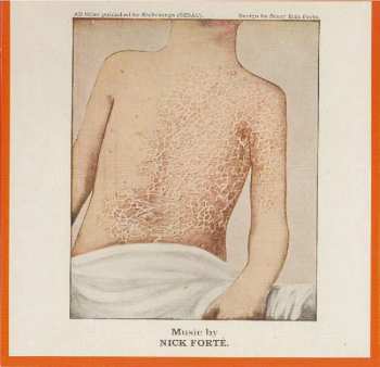 CD Nick Forté: Young Man's Disease