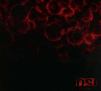 2CD OSI: Blood