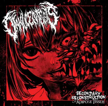 Otakucentesis: Secondary Reconstruction Of Adipose Tissue