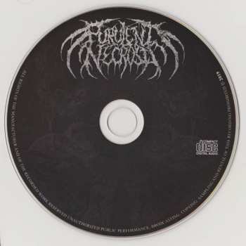 CD Purulent Necrosis: Cadaverized Humanity