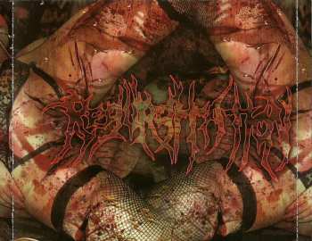 CD Regurgitation: Clitoraldectomy