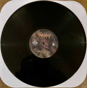 LP Sepsism: Purulent Decomposition