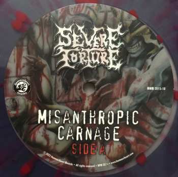 LP Severe Torture: Misanthropic Carnage