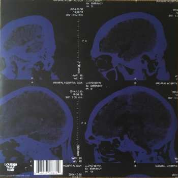 LP The Nightingales: Mind Over Matter