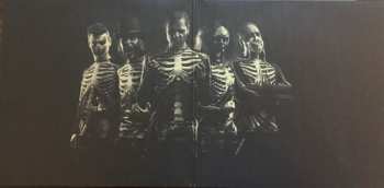 2LP The Other: Casket Case LTD
