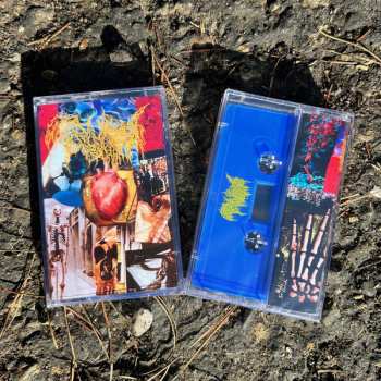 Album Trichomoniasis: Harvest Of The Killing Fields